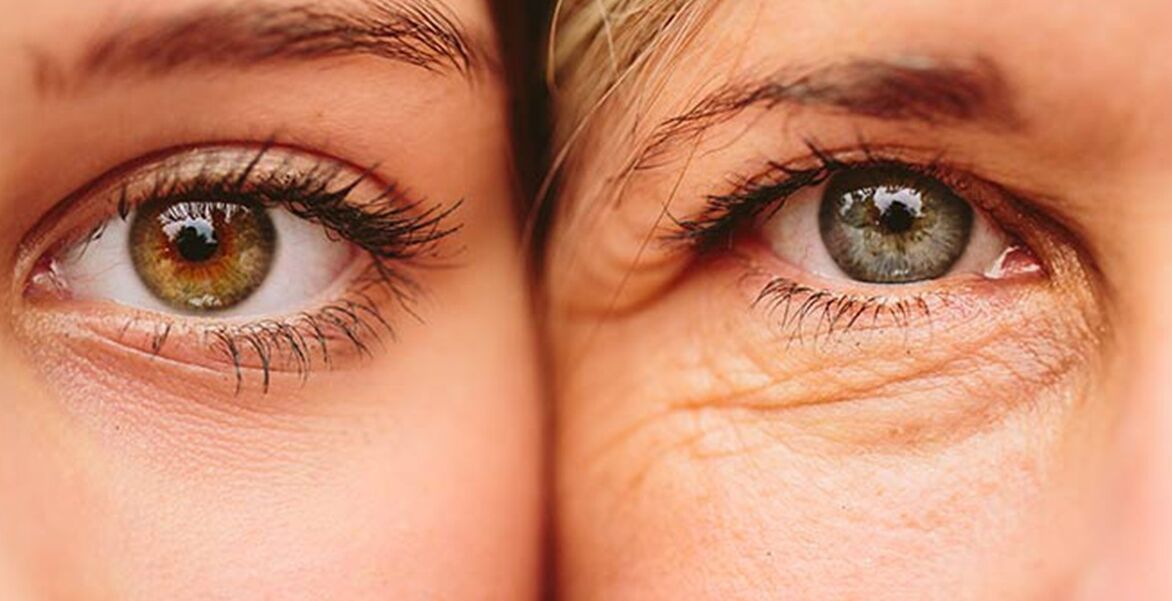 Yttre tecken på hudens åldrande runt ögonen hos två kvinnor i olika åldrar